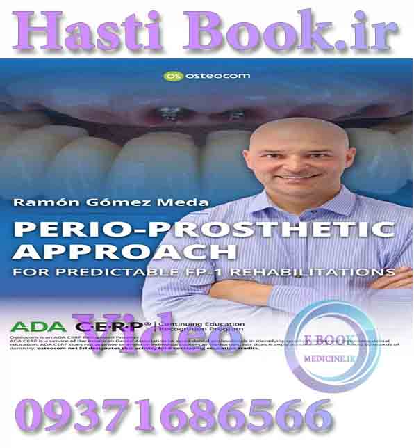 فیلم video Osteocom Perio-Prosthetic Approach, for Predictable FP-1 Rehabilitations  By Ramon Gomez Meda  (2)