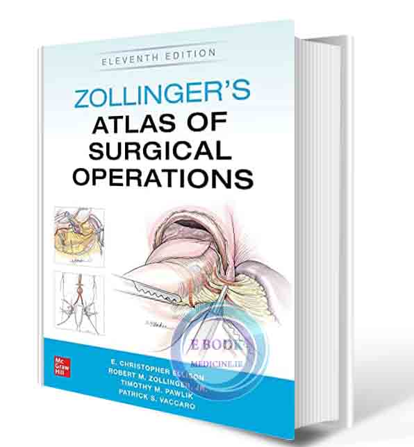 دانلود کتاب Zollinger's Atlas of Surgical Operations, 11th 2021 (Hq image PDF)